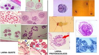 LARVA-
PROTOESCOLICES
LARVA- QUISTE
 
