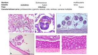 Nombre:
Estadio
Fase
Echinococcus
huevo
infectiva:
multilocularis
larva.
Huevo
evolutivo: y
Características-Larva: protoeescolex y gancho retractil, cola, ventosa, camaras multiples
 