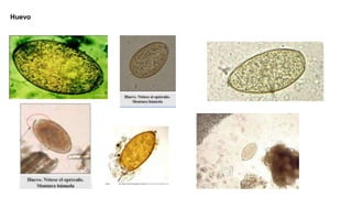 Huevo
 