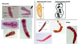 Miracidio
Esporoquiste Joven Esporoquiste Adulto
Redia
 
