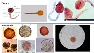 Cercaria
Metacercaria
 