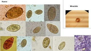 Huevo
Miracidio
 