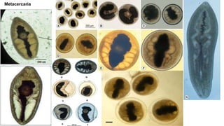 Metacercaria
 