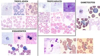 TROFO JOVEN TROFO ADULTO
ESQUIZONTES
GAMETOCITOS
 