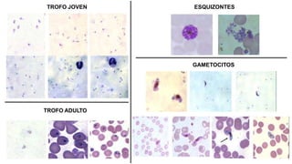 TROFO JOVEN
TROFO ADULTO
ESQUIZONTES
GAMETOCITOS
 