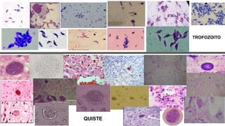 TROFOZOITO
QUISTE
 