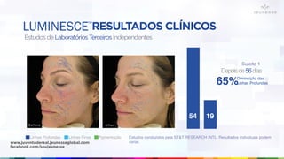 RESULTADOS CLÍNICOS
EstudosdeLaboratóriosTerceirosIndependentes
Estudos conduzidos pela ST&T RESEARCH INTL. Resultados individuais podem
variar.
Linhas Profundas Linhas Finas Pigmentação
54 19
Sujeito 1
Depoisde56dias
Diminuição das
Linhas Profundas65%
LUMINESCE™
www.juventudereal.jeunesseglobal.com
facebook.com/soujeunesse
 
