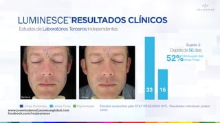 RESULTADOS CLÍNICOS
EstudosdeLaboratóriosTerceirosIndependentes
Estudos conduzidos pela ST&T RESEARCH INTL. Resultados individuais podem
variar.
Linhas Profundas Linhas Finas Pigmentação
Sujeito 2
Depoisde56dias
Diminuição das
Linhas Finas52%
33 16
LUMINESCE™
www.juventudereal.jeunesseglobal.com
facebook.com/soujeunesse
 