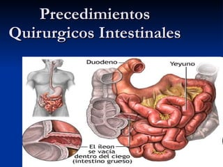 Precedimientos Quirurgicos Intestinales Dra Vanasco Veronica 2010 