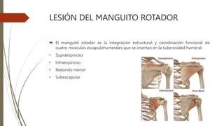 LESIÓN DEL MANGUITO ROTADOR
 El manguito rotador es la integración estructural y coordinación funcional de
cuatro músculos escapulohumerales que se insertan en la tuberosidad humeral:
• Supraespinoso
• Infraespinoso
• Redondo menor
• Subescapular
 