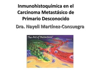 Inmunohistoquímica en el Carcinoma Metastásico de Primario Desconocido Dra. Nayeli Martínez-Consuegra 