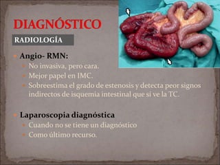  Angio- RMN:
 No invasiva, pero cara.
 Mejor papel en IMC.
 Sobreestima el grado de estenosis y detecta peor signos
indirectos de isquemia intestinal que sí ve la TC.
 Laparoscopia diagnóstica
 Cuando no se tiene un diagnóstico
 Como último recurso.
RADIOLOGÍA
 