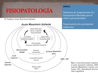 IMNO
Hipótesis de Angiotensina II y
Vasopresina liberadas por el
riñón mal perfundido
Vasoconstricción persistente
esplácnica
 