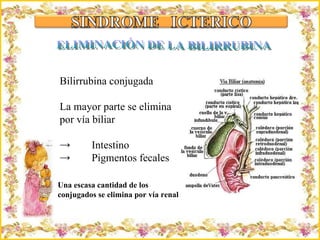 Criação Ria Slides Bilirrubina conjugada La mayor parte se elimina por vía biliar Intestino Pigmentos fecales Una escasa cantidad de los  conjugados se elimina por vía renal ELIMINACIÓN DE LA BILIRRUBINA 