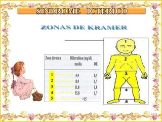 Criação Ria Slides ZONAS DE KRAMER 2 5 1 2 3 4 5 