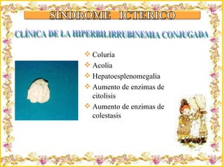 Criação Ria Slides Coluria Acolia Hepatoesplenomegalia Aumento de enzimas de citolisis Aumento de enzimas de colestasis CLÍNICA DE LA HIPERBILIRRUBINEMIA CONJUGADA 