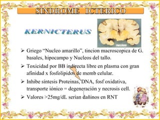 Griego “Nucleo amarillo”, tincion macroscopica de G. basales, hipocampo y Nucleos del tallo. Toxicidad por BB indirecta libre en plasma con gran afinidad x fosfolipidos de memb celular. Inhibe síntesis Proteinas, DNA, fosf oxidativa,  transporte iónico = degeneración y necrosis cell. Valores >25mg/dL serian dañinos en RNT Criação Ria Slides KERNICTERUS 