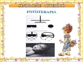 Criação Ria Slides FOTOTERAPIA 