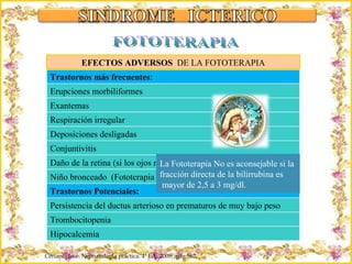 Criação Ria Slides FOTOTERAPIA EFECTOS ADVERSOS  DE LA FOTOTERAPIA La Fototerapia No es aconsejable si la  fracción directa de la bilirrubina es mayor de 2,5 a 3 mg/dl. Ceriani,  José. Neonatología práctica. 4ª Ed,  2009;  pág 562. Trastornos más frecuentes : Erupciones morbiliformes Exantemas Respiración irregular Deposiciones desligadas Conjuntivitis Daño de la retina (si los ojos no estan bien protegidos) Niño bronceado  (Fototerapia en RN con Bilirrubina a pred. Directo)  Trastornos Potenciales: Persistencia del ductus arterioso en prematuros de muy bajo peso Trombocitopenia Hipocalcemia 