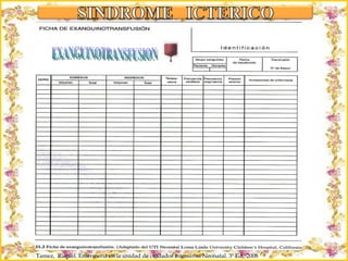 Criação Ria Slides Tamez,  Raquel. Enfermería en la unidad de cuidados intensivos Neonatal. 3ª Ed,  2008 EXANGUINOTRANSFUSION 