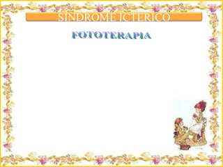 Criação Ria Slides FOTOTERAPIA SINDROME ICTERICO 