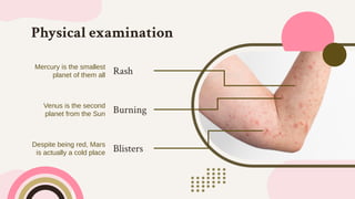 Merc Rash Copia de Skin Diseases: Herpes Zoster Case Report by Slidesgo.pdf