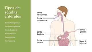 Tipos de
sondas
enterales
Sonda Nasogástrica
Sonda Buco-gástrica
Sonda Duodenal
Sonda Yeyunal
Gastrostomía
Yeyunostomia
 
