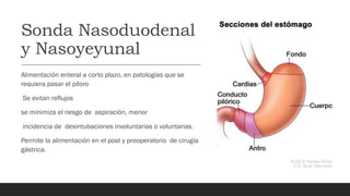 Sonda Nasoduodenal
y Nasoyeyunal
Alimentación enteral a corto plazo, en patologías que se
requiera pasar el píloro
Se evitan reflujos
se minimiza el riesgo de aspiración, menor
incidencia de desintubaciones involuntarias o voluntarias.
Permite la alimentación en el post y preoperatorio de cirugía
gástrica.
 