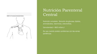 Nutrición Parenteral
Central
Nutrición completa: Solución de glucosa, lípidos,
aminoácidos, vitaminas y electrolitos.
Osmolaridad > 800 mOsm/l
Se usa cuando existen problemas con las venas
periféricas.
 
