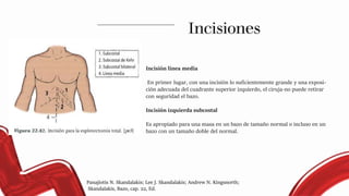 Incisión línea media
En primer lugar, con una incisión lo suficientemente grande y una exposi-
ción adecuada del cuadrante superior izquierdo, el ciruja-no puede retirar
con seguridad el bazo.
Incisión izquierda subcostal
Es apropiado para una masa en un bazo de tamaño normal o incluso en un
bazo con un tamaño doble del normal.
Incisiones
Panajiotis N. Skandalakis; Lee J. Skandalakis; Andrew N. Kingsnorth;
Skandalakis, Bazo, cap. 22, Ed.
 