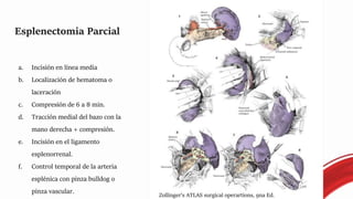 Esplenectomia Parcial
a. Incisión en línea media
b. Localización de hematoma o
laceración
c. Compresión de 6 a 8 min.
d. Tracción medial del bazo con la
mano derecha + compresión.
e. Incisión en el ligamento
esplenorrenal.
f. Control temporal de la arteria
esplénica con pinza bulldog o
pinza vascular.
Zollinger’s ATLAS surgical operartions, 9na Ed.
 