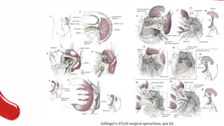 Zollinger’s ATLAS surgical operartions, 9na Ed.
 