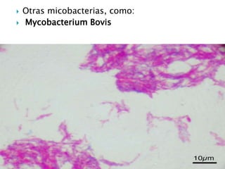  Otras micobacterias, como:
 Mycobacterium Bovis
 