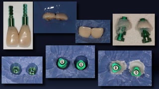 Tissue Management of Peri-implant Tissue