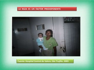 LA RAZA ES UN FACTOR PREDISPONENTE




Fuente: Hospital Central de Valera. Edo Trujillo. 2003
 