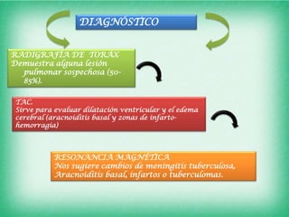 DIAGNÓSTICO


RADIGRAFÍA DE TORÁX
Demuestra alguna lesión
  pulmonar sospechosa (50-
  85%).

 TAC.
 Sirve para evaluar dilatación ventricular y el edema
 cerebral (aracnoiditis basal y zonas de infarto-
 hemorragia)




            RESONANCIA MAGNÉTICA
            Nos sugiere cambios de meningitis tuberculosa,
            Aracnoiditis basal, infartos o tuberculomas.
 