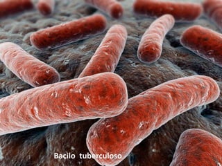 Bacilo tuberculoso
 