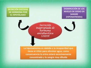 SECRECIÓN EXCESIVA                                 DISMINUCIÓN DE LOS
 DE HORMONA POR                                    NIVELES DE SODIO EN
  EL HIPOTÁLAMO                                          SANGRE
                                                     (HIPONATREMIA)


                            Secreción
                         inapropiada de
                            hormona
                          antidiurética
                             SADH




              La hiponatremia es debida a la incapacidad que
                  tiene el riñón para eliminar agua, como
                consecuencia la orina estará excesivamente
                    concentrada y la sangre muy diluida
 