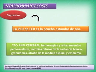 NEUROBRUCELOSIS

  Diagnóstico




           La PCR de LCR es la prueba estandar de oro.



        TAC- RNM CEREBRAL: hemorragias y reforzamientos
      perivasculares, cambios difusos de la sustancia blanca,
       granulomas, atrofia de la médula espinal y empiema.


Presentación aguda de neurobrucelosis en un paciente pediátrico. Reporte de un caso.Enfermedades Infecciosas y
Microbiología, vol. 30, núm. 1, enero-marzo 2010
 