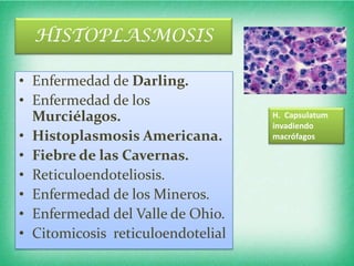 HISTOPLASMOSIS

• Enfermedad de Darling.
• Enfermedad de los
  Murciélagos.                     H. Capsulatum
                                   invadiendo
• Histoplasmosis Americana.        macrófagos

• Fiebre de las Cavernas.
• Reticuloendoteliosis.
• Enfermedad de los Mineros.
• Enfermedad del Valle de Ohio.
• Citomicosis reticuloendotelial
 