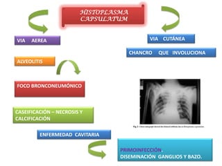 HISTOPLASMA
                        CAPSULATUM


VIA   AEREA                                 VIA CUTÁNEA

                                      CHANCRO   QUE INVOLUCIONA
ALVEOLITIS



FOCO BRONCONEUMÓNICO



CASEIFICACIÓN – NECROSIS Y
CALCIFICACIÓN

         ENFERMEDAD CAVITARIA

                                 PRIMOINFECCIÓN.
                                 DISEMINACIÓN GANGLIOS Y BAZO.
 