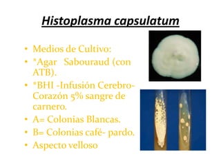 Histoplasma capsulatum

• Medios de Cultivo:
• *Agar Sabouraud (con
  ATB).
• *BHI -Infusión Cerebro-
  Corazón 5% sangre de
  carnero.
• A= Colonias Blancas.
• B= Colonias café- pardo.
• Aspecto velloso
 