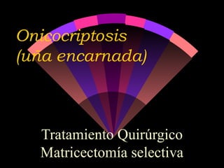 Onicocriptosis
(uña encarnada)
Tratamiento Quirúrgico
Matricectomía selectiva
 