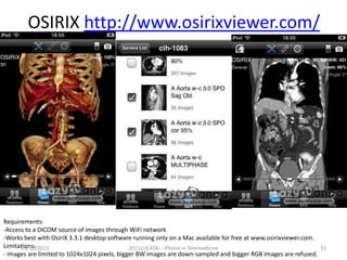 OSIRIX http://www.osirixviewer.com/

Requirements:
-Access to a DICOM source of images through WiFi network
-Works best with OsiriX 3.3.1 desktop software running only on a Mac available for free at www.osirixviewer.com.
Limitations:
03/12/2013
2011(c)CATAI - iPhone in Telemedicine
31
- images are limited to 1024x1024 pixels, bigger BW images are down-sampled and bigger RGB images are refused.

 