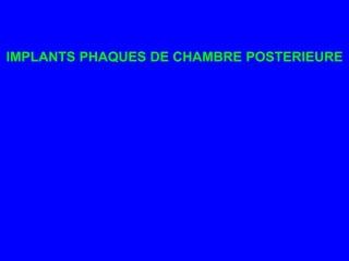 IMPLANTS PHAQUES DE CHAMBRE POSTERIEURE
 