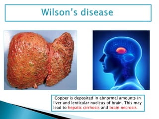Copper clinical importance for medical students | PPTX