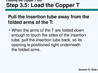 Copper T insertion