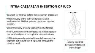 INTRA-CAESAREAN INSERTION OF IUCD
•Counsell for PPIUCD before the caesarean procedure
•After delivery of the baby and placenta and
evaluation for PPH but prior to closure of uterine
incision.
•Either manually or using sponge holding forceps
•Hold IUCD between the middle and index fingers of
the hand and pass it through the uterine incision
•IUCD strings can be pointed towards lower uterine
segment but should NOT be pushed through the
cervical canal.
Holding the IUCD
between middle and
index finger
 