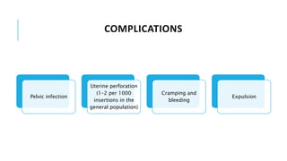 COMPLICATIONS
Pelvic infection
Uterine perforation
(1–2 per 1000
insertions in the
general population)
Cramping and
bleeding
Expulsion
 