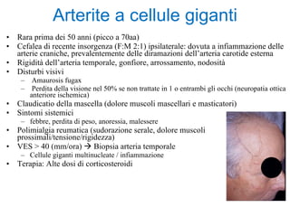 Rara prima dei 50 anni (picco a 70aa) Cefalea di recente insorgenza (F:M 2:1) ipsilaterale: dovuta a infiammazione delle arterie craniche, prevalentemente delle diramazioni dell’arteria carotide esterna Rigidità dell’arteria temporale, gonfiore, arrossamento, nodosità Disturbi visivi Amaurosis fugax Perdita della visione nel 50% se non trattate in 1 o entrambi gli occhi (neuropatia ottica anteriore ischemica) Claudicatio della mascella (dolore muscoli mascellari e masticatori) Sintomi sistemici febbre, perdita di peso, anoressia, malessere Polimialgia reumatica (sudorazione serale, dolore muscoli prossimali/tensione/rigidezza) VES > 40 (mm/ora)    Biopsia arteria temporale Cellule giganti multinucleate / infiammazione Terapia: Alte dosi di corticosteroidi Arterite a cellule giganti 